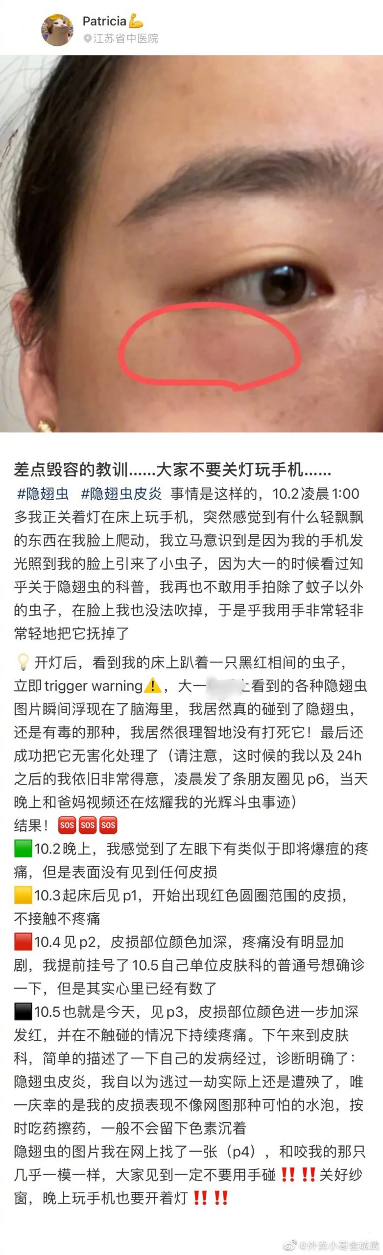 又是它！女子半夜关灯玩手机，差点致毁容！
