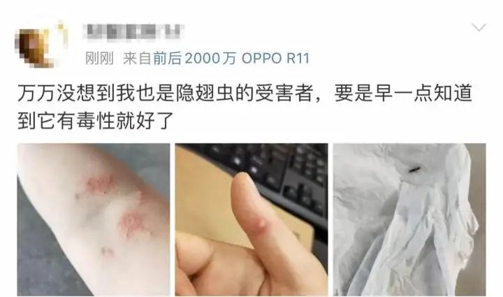 又是它！女子半夜关灯玩手机，差点致毁容！