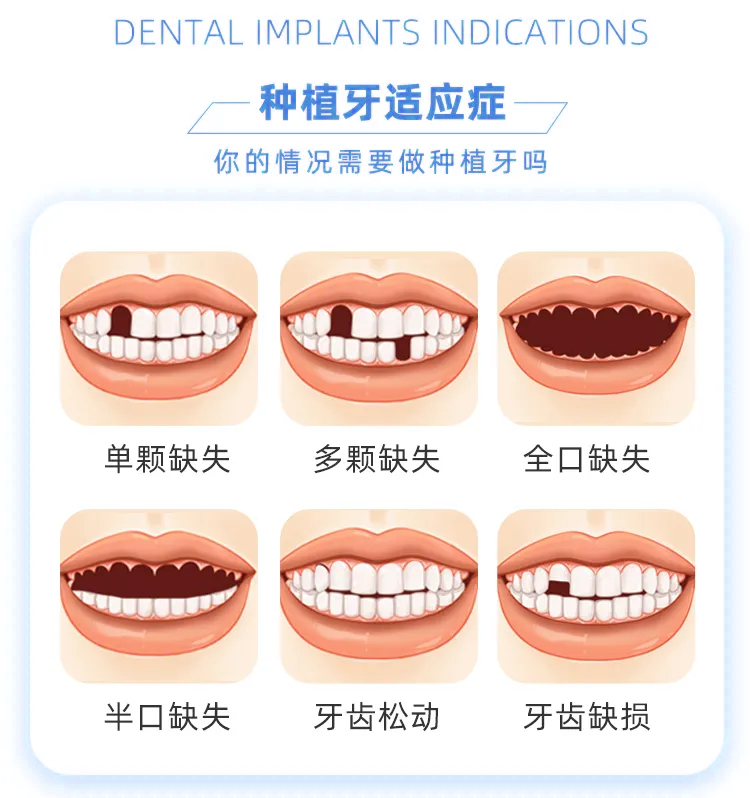 东莞5月新增一笔补助，符合条件的快来申领！