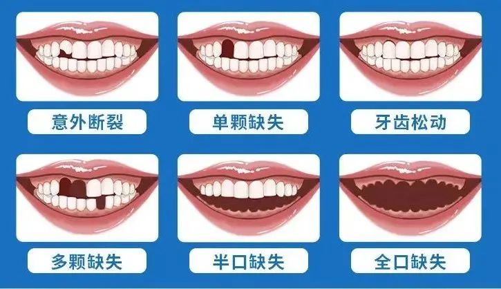 通知！东莞新增一项补贴，取消户籍限制，在莞居民均可申领！