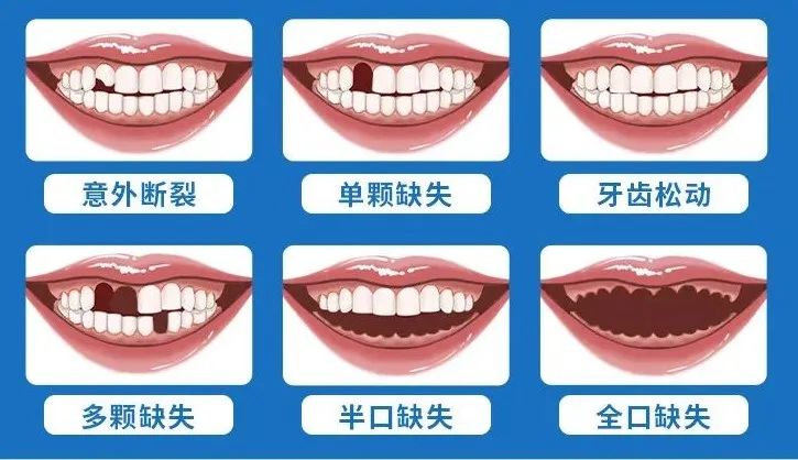 月通知！东莞新增一项补贴，不限户籍，均可申领！"