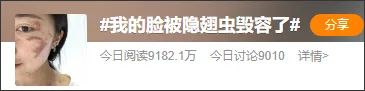 东莞随处可见！“我的脸被它毁容了！”千万不要打！