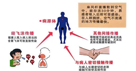 东莞人警惕！广东一地发现2例！出现这些症状要当心→