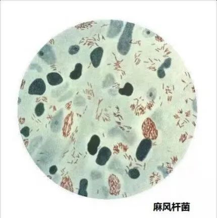东莞人警惕！广东一地发现2例！出现这些症状要当心→