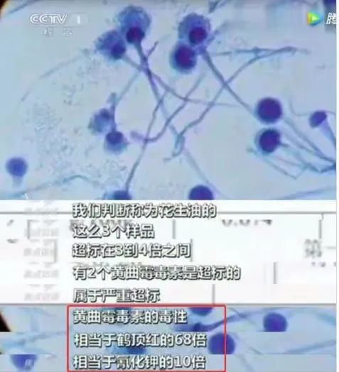 连吐10余次，12岁男孩紧急送医！春节这个坏习惯很多人都有→