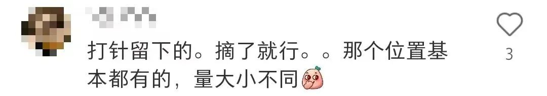 山姆超市又出事！被曝猪肉上有虫卵！涉事门店回应