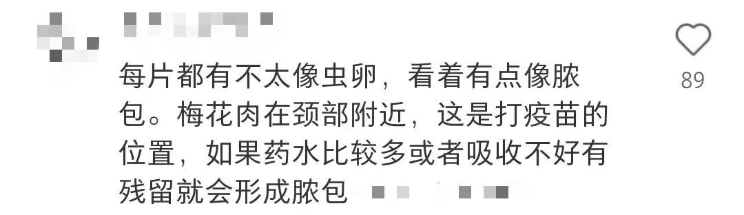 山姆超市又出事！被曝猪肉上有虫卵！涉事门店回应